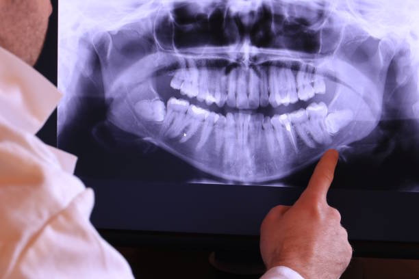 Best Emergency Treatment for Toothache in Rushville, IN