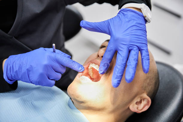 Best Emergency Tooth Extraction in Rushville, IN